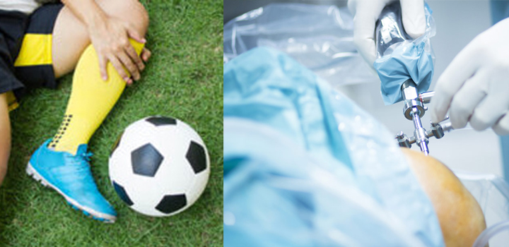 Arthroscopy and sports injuries